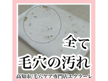 エクラーレ(Eclale)/【毛穴ケア】症例