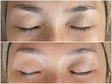 メイン(main)/★before after★