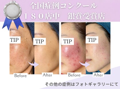 ハービー(Herbee)の写真