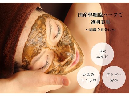 カラーリリー(calla lily)の写真