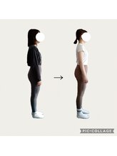 フォーシー(4C)/Before /After