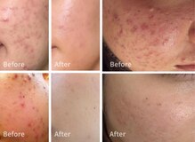 マリヴェリーテ(Mari verite)