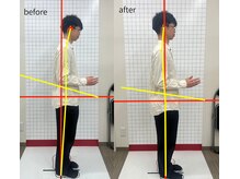 ほねつぎ 高津はりきゅう接骨院/猫背・ストレートネック★