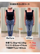 くさば整骨院/44歳女性/ダイエット3か月コース