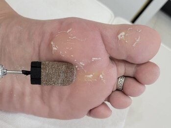 ネイルサロンシャネイルの写真/かかとすべすべ角質ケアでつるつる美肌へ！乾燥など気になる方も◎なめらか足裏に導きます★