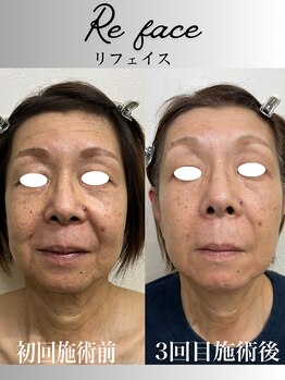 コリー(Kolly)/まるで別人級！