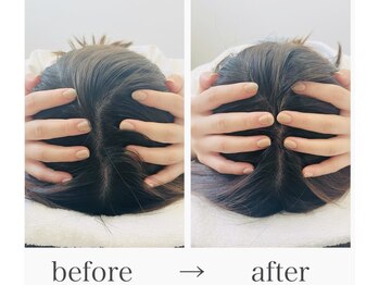 エレランサ/頭の大きさの変化(１回)