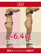 アイリスエステサロン 江州店/ビフォーアフター【3】