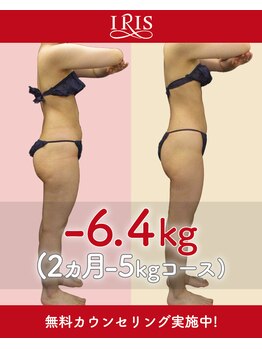 アイリスエステサロン 江州店/ビフォーアフター【3】