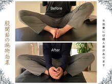 ボディ リセット アンド デザイン(Body Reset & Design)/【施術例】ビフォーアフター