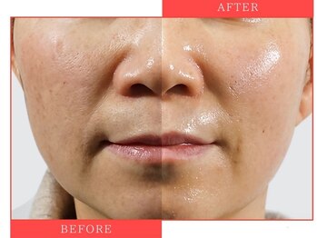 レディラックビューティー 横浜(Lady Luck beauty)/肌育ララピール★横浜/馬車道