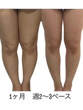 ヨサパーク ベルチャーム 金町店(YOSAPARK BelleCharm)&nbsp;Before after2