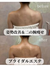 ウンスイスパ(UNSUI SPA)