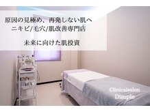 ディンプル(Dimple)