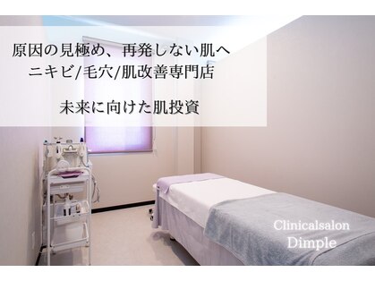 ディンプル(Dimple)の写真