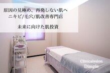 ディンプル(Dimple)