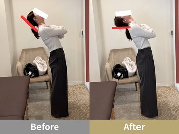 せなかのはね 井尻店/20代　肩こり　猫背　首こり