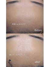 ベルティ(Bellti)/時を戻そう！フェイシャルエステ