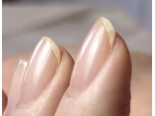 ロイヤル ネイルサロン(Royal nail Saloon)の雰囲気（根本から爪を健康に育て縦長美爪に！悩まずご相談下さい…）