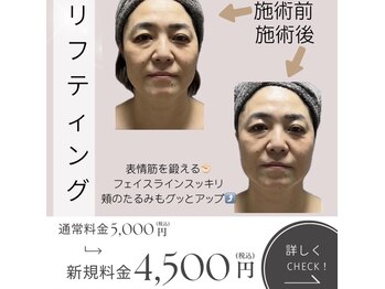 きれい塾 恵比寿/リフティング