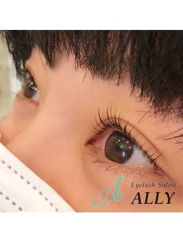アリー(ALLY)/