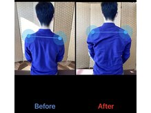 ふくろう/姿勢改善事例（肩の歪み）
