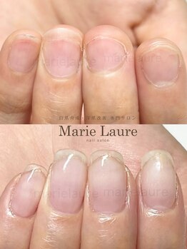 マリーロール 淀屋橋本店(Marie Laure)/自爪育成/深爪矯正/ネイルケア
