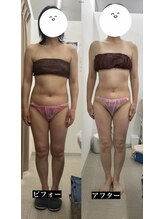 メリアミーゴ(Meli amigo)/40代　痩身ダイエット