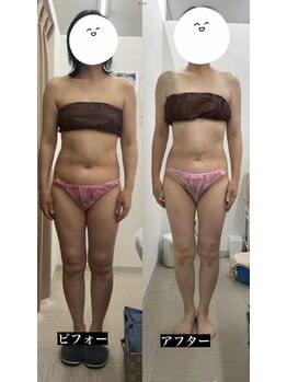 メリアミーゴ(Meli amigo)/40代 痩身ダイエット