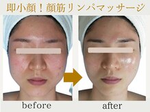 りりあす