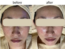 マイルーム(my room)/【before/after】