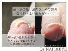 爪のコンプレックやケアや深爪育成メニューで清潔感ある指先に！