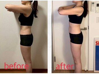 リリィ(RIRY)/【BODY ビフォーアフター】