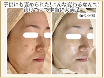 ポモナ 横浜馬車道店(Pomona)/シミケア・シミ改善美肌ケア