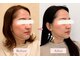 エキュレ ジャーニー トゥ マイ トータル ビューティー(equrer)の写真