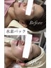  【肌荒れ/日焼け後にも】水素パック×美肌ハンドフェイシャル50分￥6,600