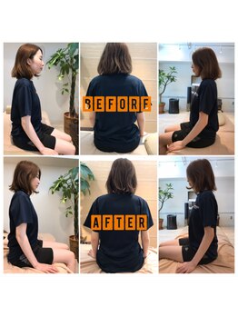 中目黒整体クマハラアスリートサポート/20代女性 産後の骨盤矯正