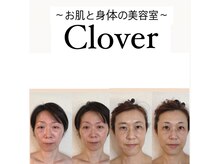 クローバー(clover)