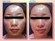 ジュリア オージェ 梅田店/ビフォーアフター（フォトFa)