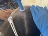 特典あり☆【結果重視】プロセルセラピーズ毛活促進ケア　3回コース