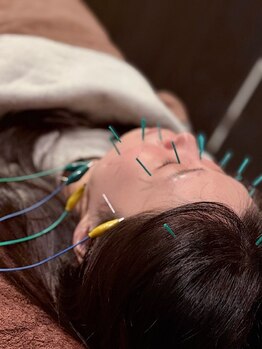 えにし整体 鍼灸整骨院/効果絶大☆電気美容鍼