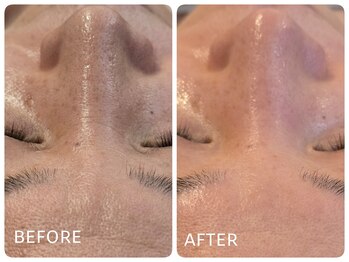 ミイエステ(miiest)/BeforeAfter