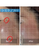 ナツミ(723)/感動シミケアメニュー！