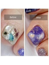 ヴィヴィアンヌ(VIVIANNE)/巻き爪改善