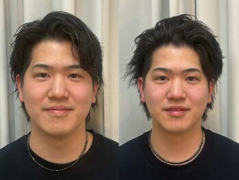 エムケー(M.K.)/浮腫解消 小顔矯正
