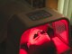 ハリスト(HARIST)の写真/鍼とLEDライトの力で育毛促進が可能!お肌のハリもアップ!薄いシミにも効果あり!夢のような施術です