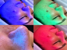 シミケア＆小顔専門サロン　ルアン～月艶～の雰囲気（未来のシミなど見極めるライトでまずはスキンチェック）
