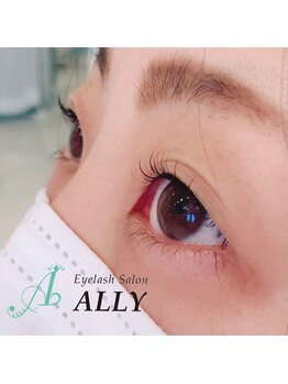 アリー(ALLY)/