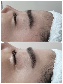 エステシェービングサロン フルール(Fleur)/眉毛のビフォーアフター