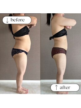 トータルビューティーサロンリア(Li'a)/ビフォー＆アフター